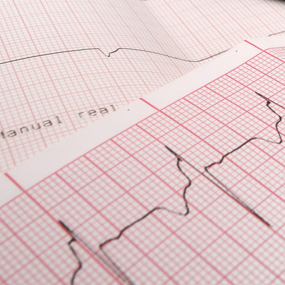 Carta Termica per Elettrocardiografi ECG