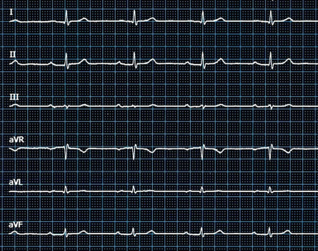 Guida per eseguire ed interpretare un ECG in modo professionale